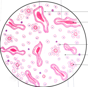 Pathology secretory endometrium Dyssynchronous secretory