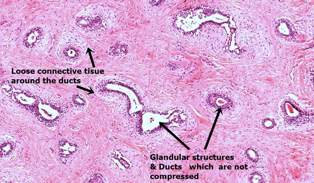 Overview of the Breast - Breast Pathology