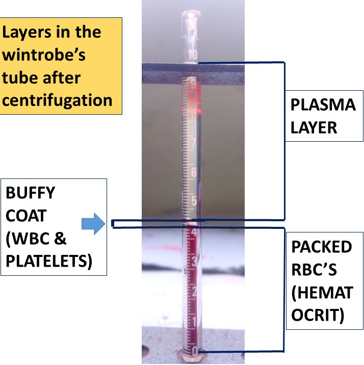 WINTROBE TUBE - Pathology Made Simple