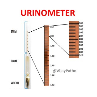 A Urinometer Is Used To Measure Which Of The Following Careytrust A Urinometer Is Used To Measure Which Of The Following Careytrust