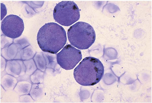 cytochemicalstainsinhematologypdf