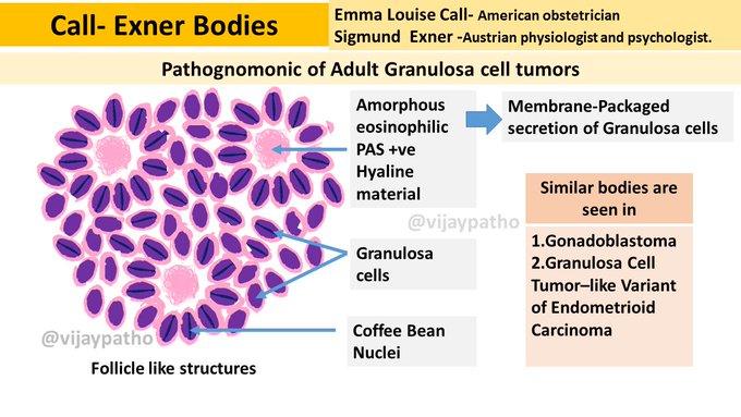 GRANULOSA CELL TUMOR OVARY Pathology Made Simple