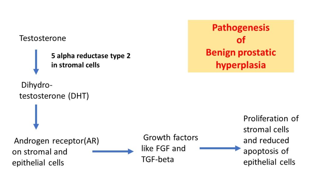 benign prostatic hyperplasia pathogenesis