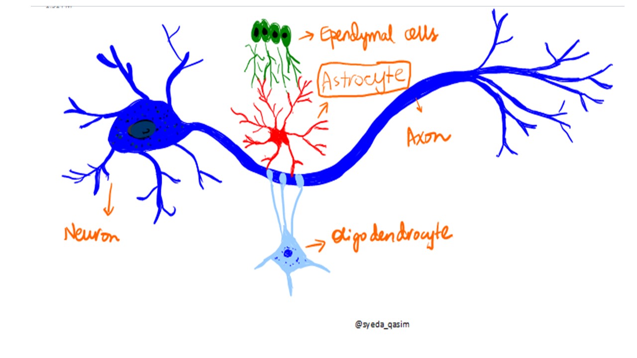 pathology-of-astrocytoma-pathology-made-simple