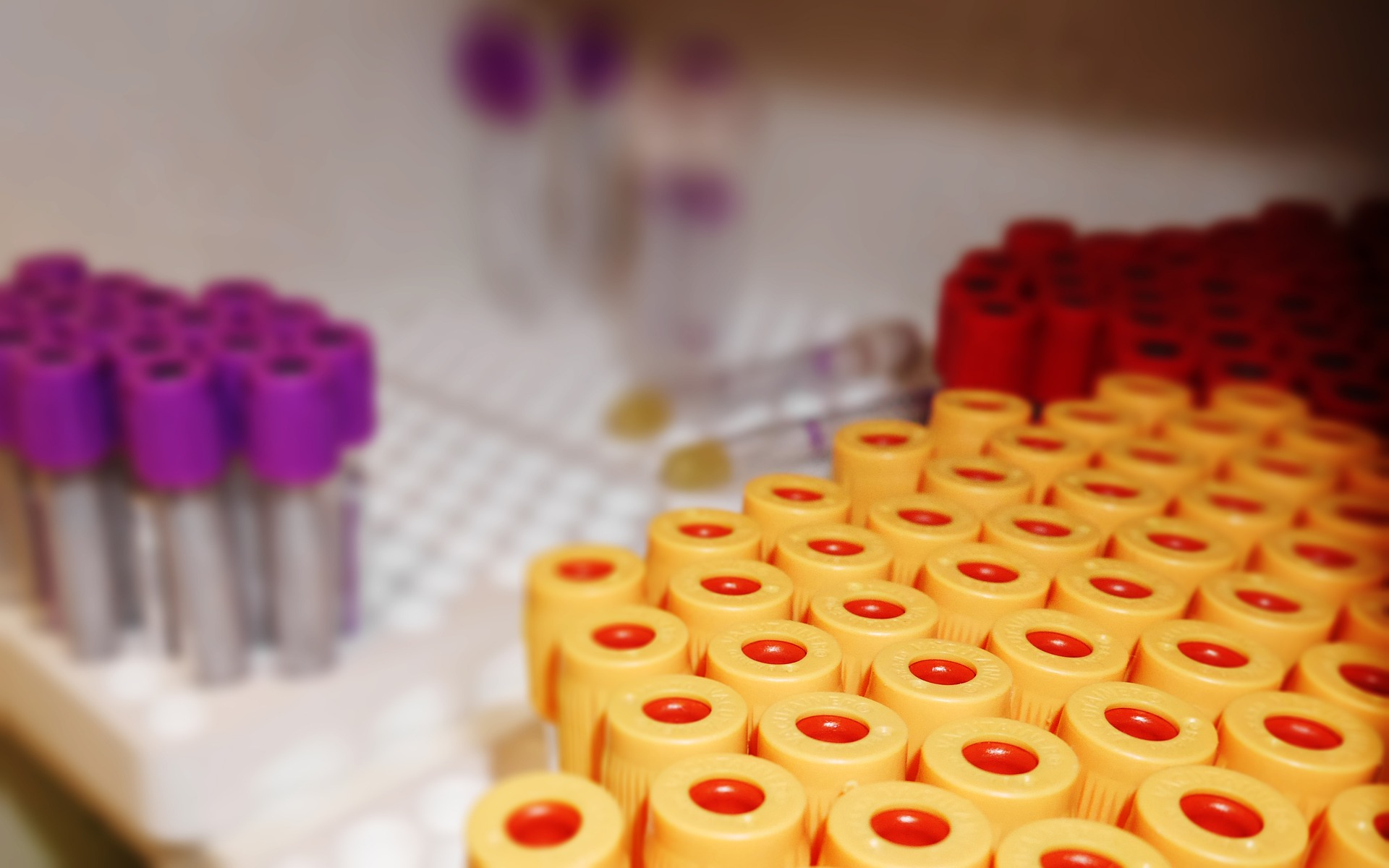 vacutainer-tubes-and-their-uses-pathology-made-simple