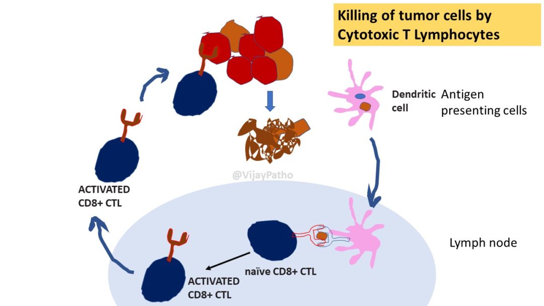 TUMOR IMMUNITY Pathology Made Simple