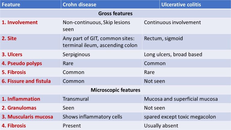 Pathology Of Ulcerative Colitis Pathology Made Simple 3944