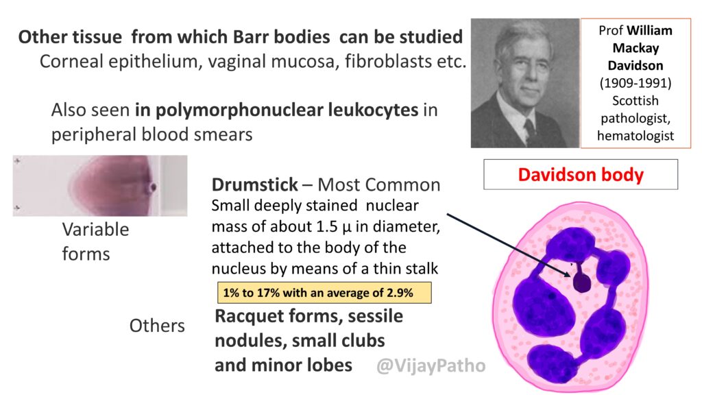 Barr Body X Chromatin Sex Chromatin And Davidson Body Pathology Made Simple