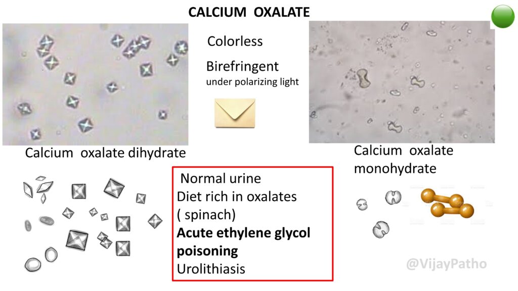 calcium oxalate crystals in synovial fluid