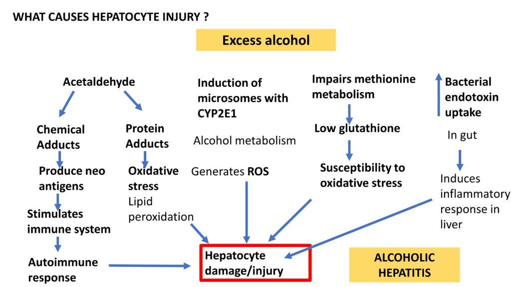 Alcoholic Liver Disease Types And Pathogenesis Pathology Made Simple