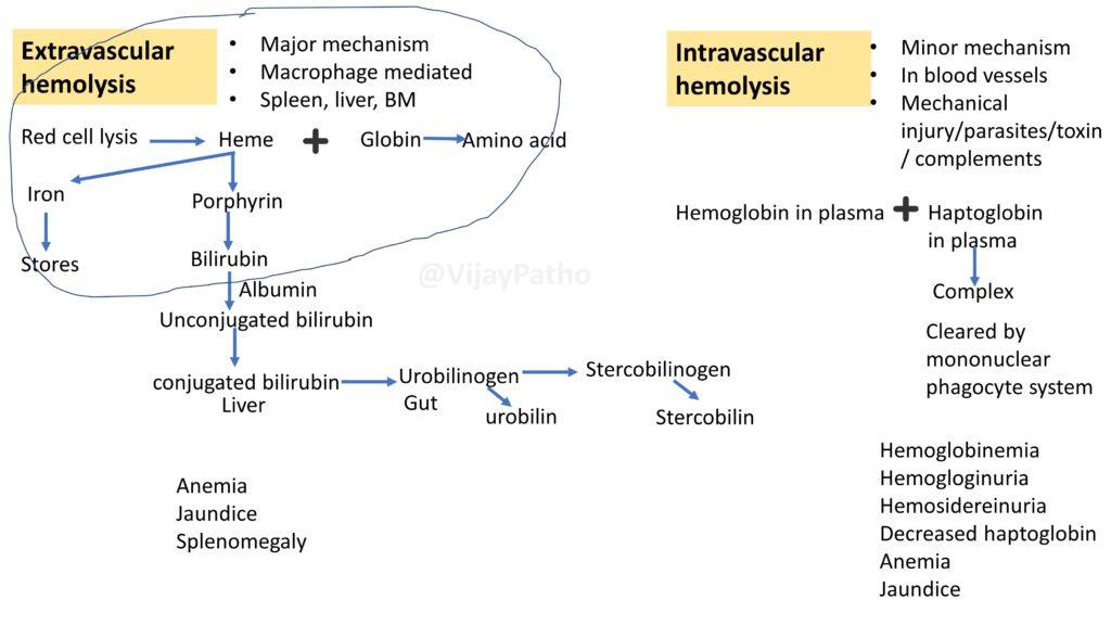 Hemolytic Anemia Extravascular Vs Intravascular Hemolysis