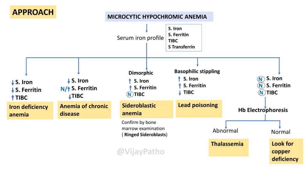 Microcytic Hypochromic Anemia Causes And Diagnosis Pathology Made Simple
