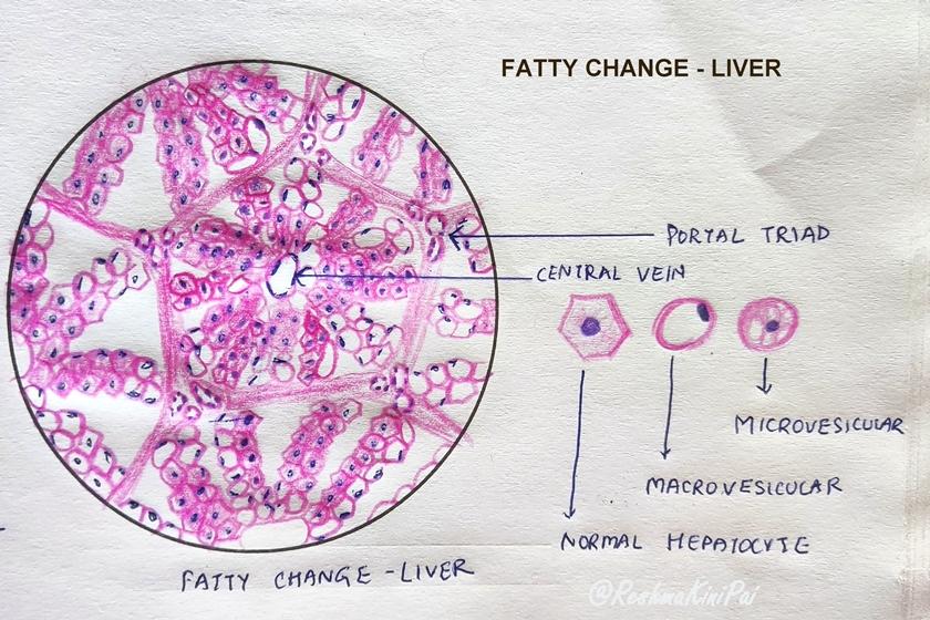PATHOLOGY PRACTICAL ILLUSTRATIONS SYSTEMIC PATHOLOGY Pathology Made PATHOLOGY PRACTICAL ILLUSTRATIONS SYSTEMIC PATHOLOGY Pathology Made