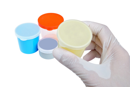 Sputum Analysis: Common Questions