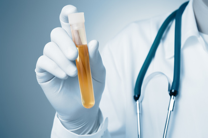 Synovial Fluid Analysis: Common Questions