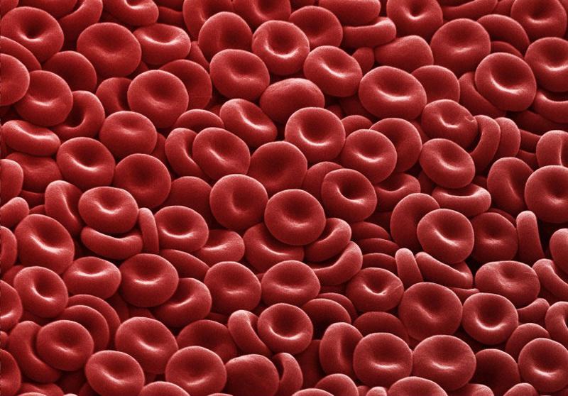 The normal red blood cells looks like donuts 