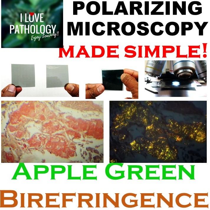Polarizing Microscopy Simplified! Apple Green Birefringence.