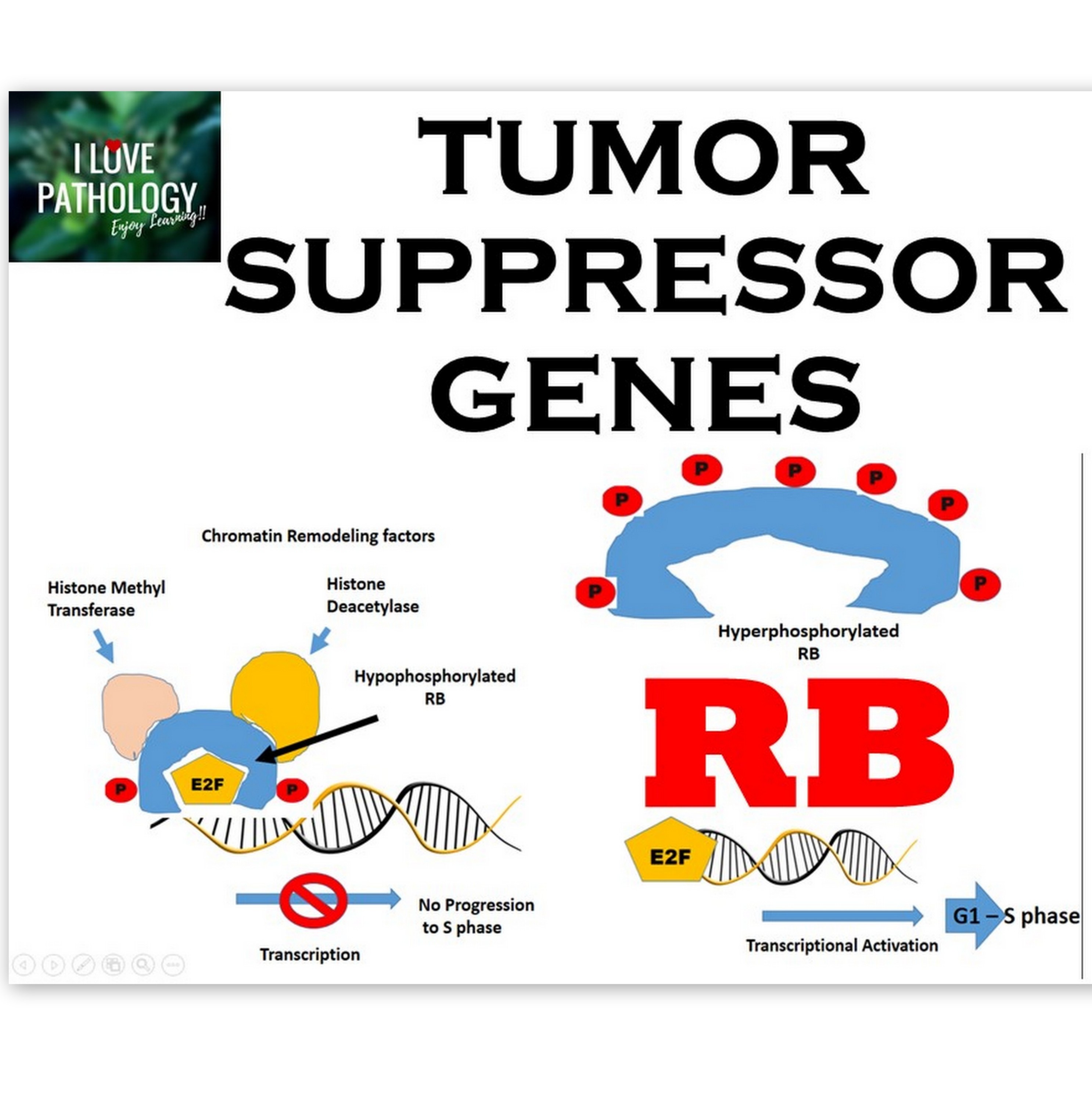 Tumor Suppressor Genes: RB Gene, Knudson’s Two Hit Hypothesis