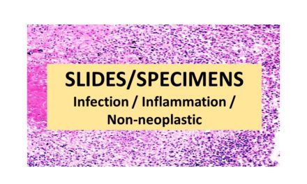 SLIDES/SPECIMENS: Infection / Inflammation / Non-Neoplastic