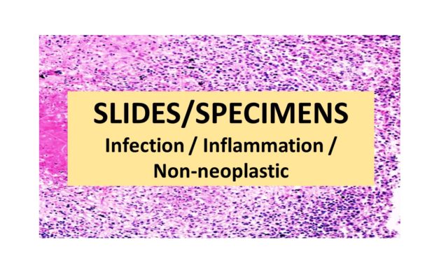 SLIDES/SPECIMENS: Infection / Inflammation / Non-Neoplastic