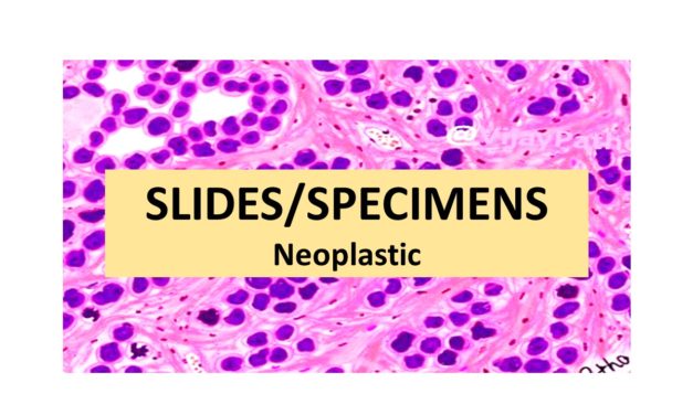 SLIDES/SPECIMENS: Neoplastic