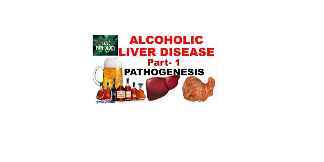 Alcoholic liver disease: Types & Pathogenesis