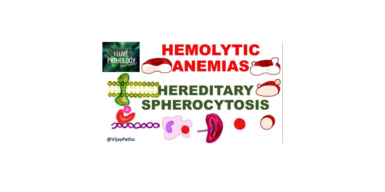 Pathology of Hereditary Spherocytosis