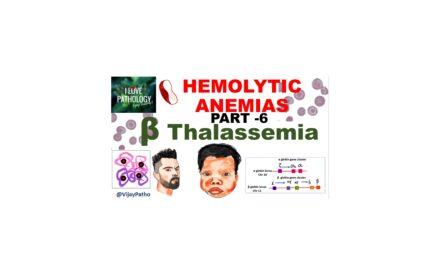 Pathology of β-thalassemia