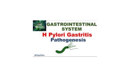 H Pylori gastritis