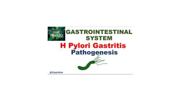 H Pylori gastritis