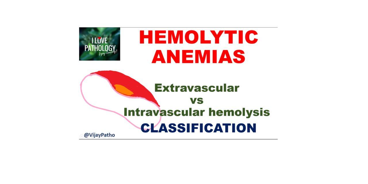 HEMOLYTIC ANEMIA – Extravascular vs Intravascular hemolysis, Classification.