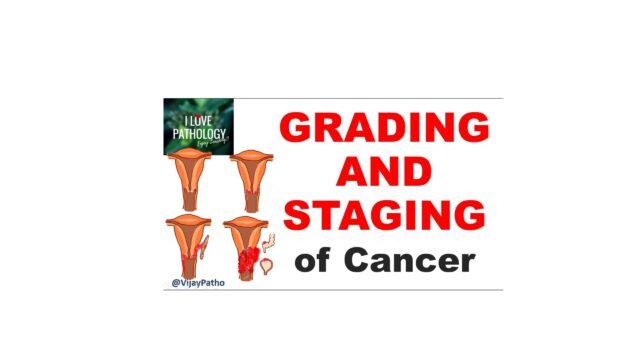 GRADING AND STAGING OF CANCER