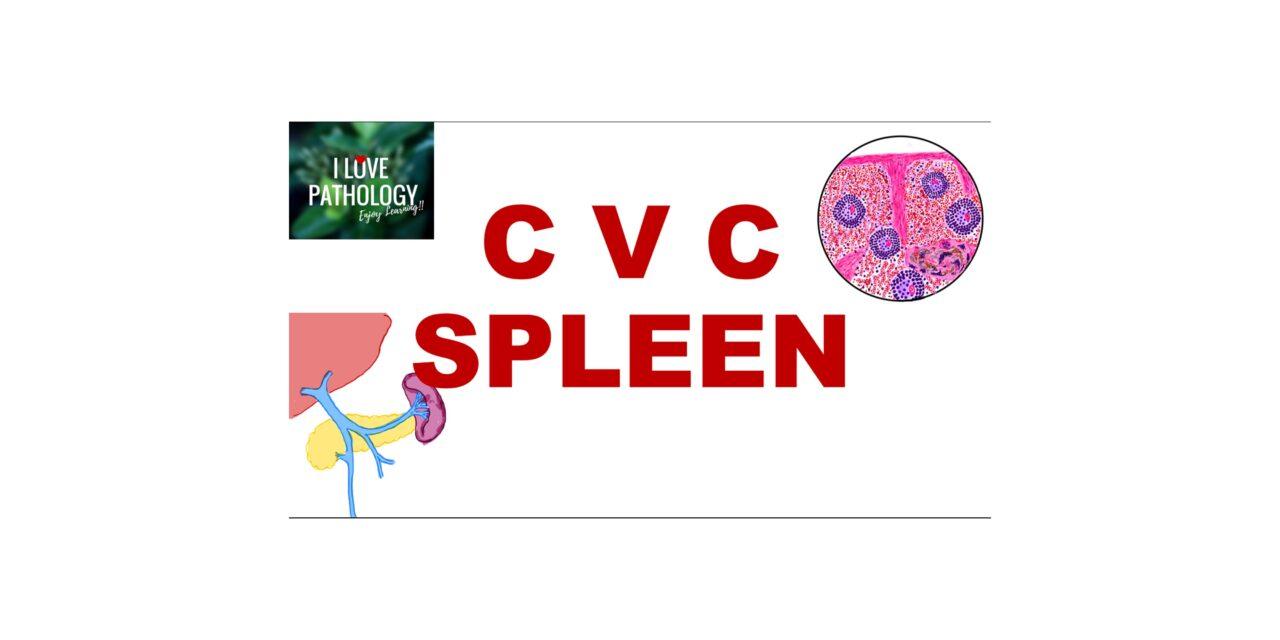Chronic Venous Congestion : Spleen