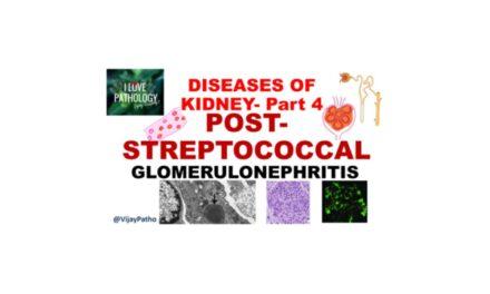 Acute Post Streptococcal Glomerulonephritis
