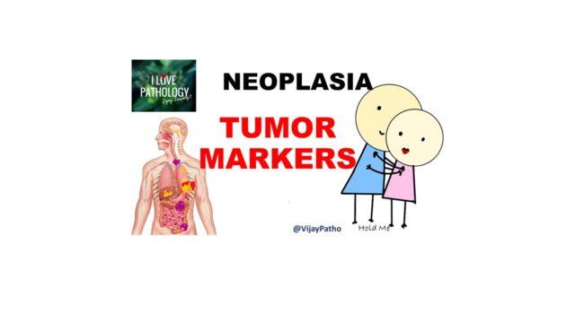 tumor markers thesis