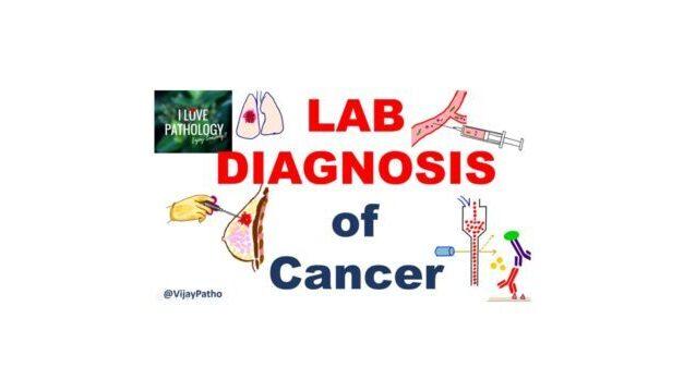 Lab Diagnosis of cancer