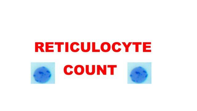 21+ Reticulocyte Index Calculator