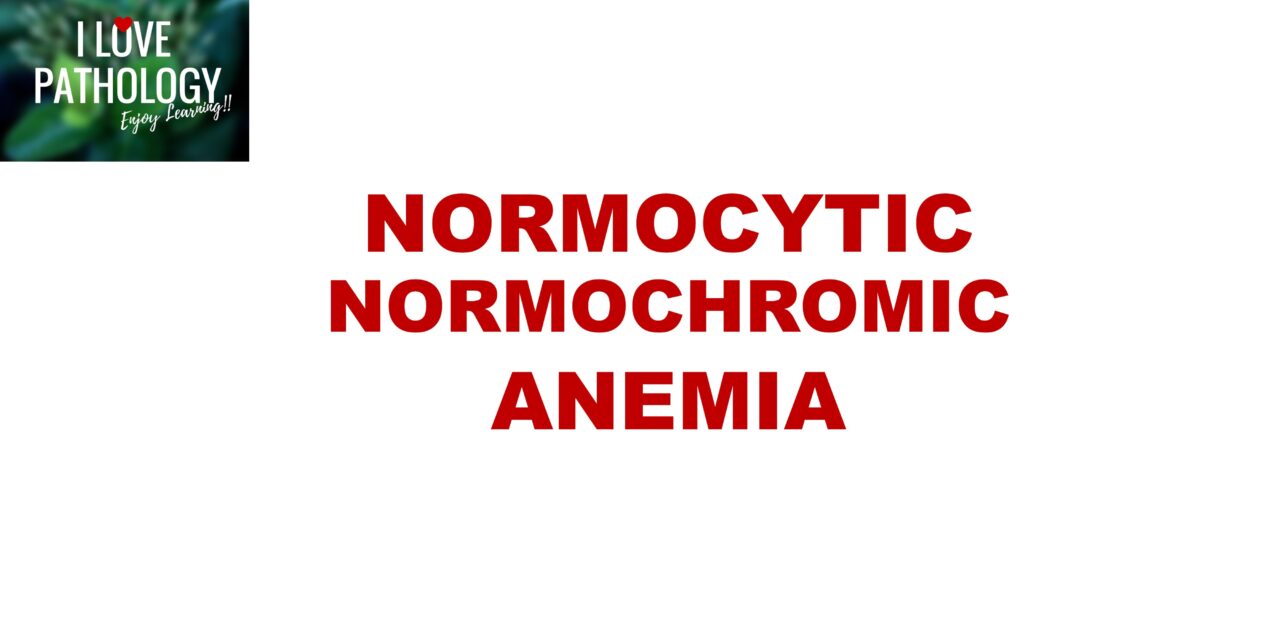 Normocytic Normochromic anemia
