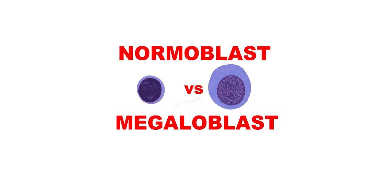 Normoblast vs Megaloblast