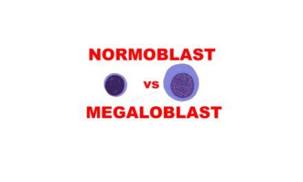 Normoblast vs Megaloblast