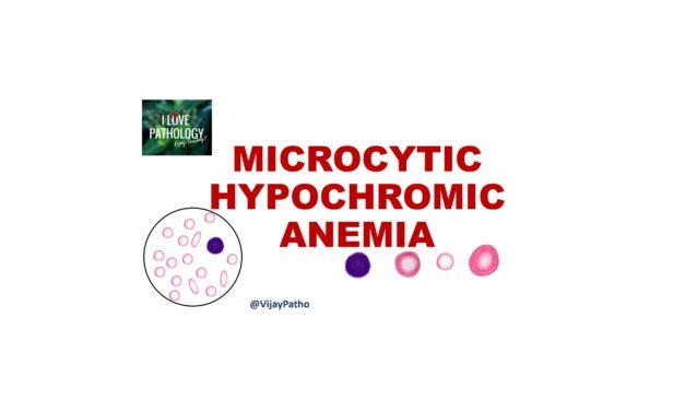  Microcytic Hypochromic Anemia: Causes and Diagnosis