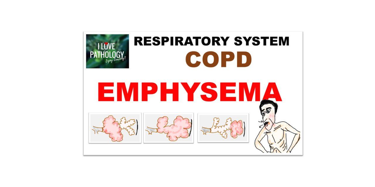 Emphysema: Etiopathogenesis, clinical features  and Diagnosis