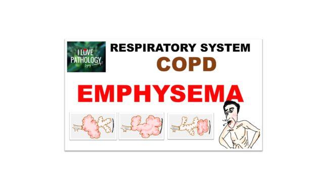 Emphysema: Etiopathogenesis, clinical features  and Diagnosis