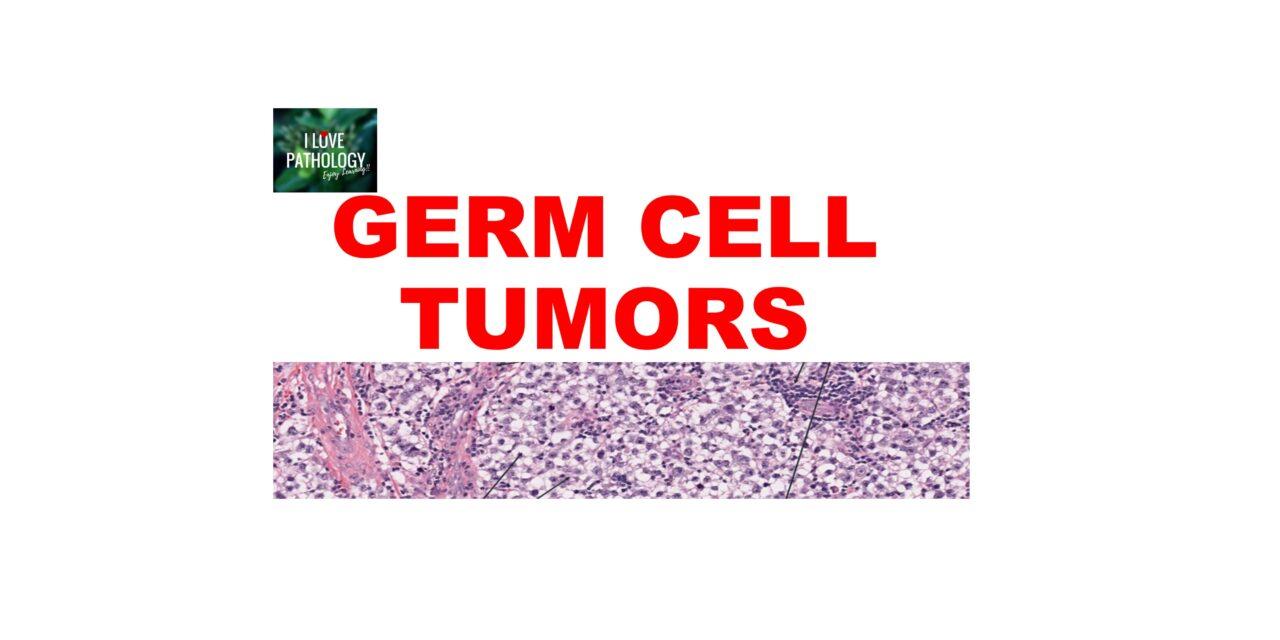 Germ cell tumors- Ovary