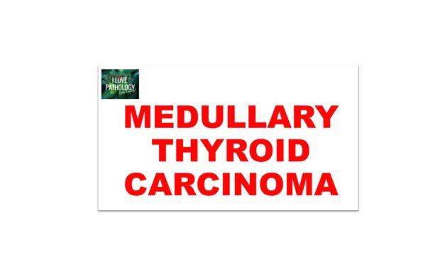 MEDULLARY THYROID CARCINOMA