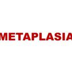 Metaplasia:  Types and  Causes