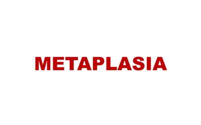 Metaplasia:  Types and  Causes