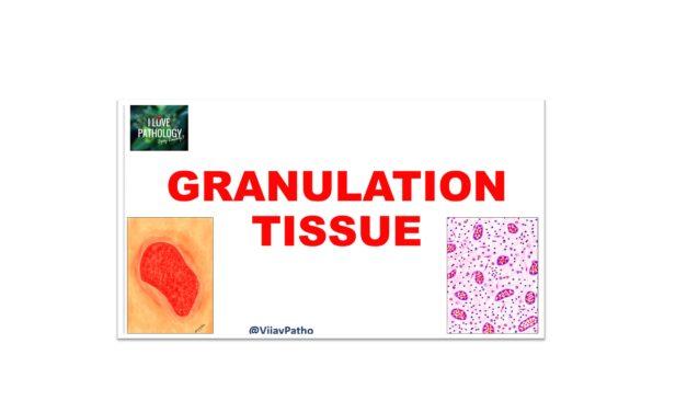 Granulation tissue