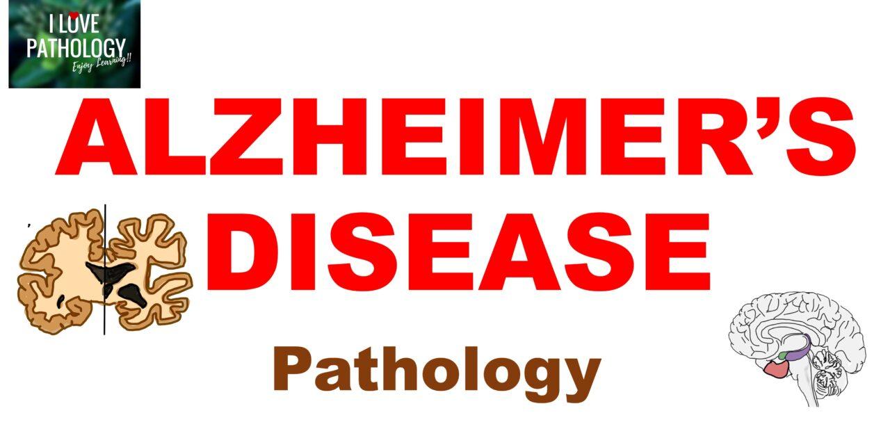 Alzheimer’s disease – Pathology and clinical features