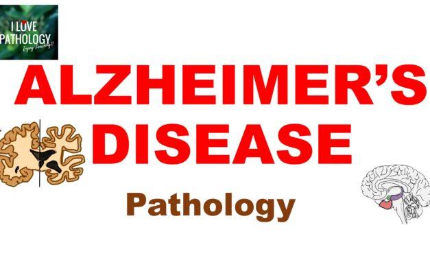 Alzheimer’s disease – Pathology and clinical features